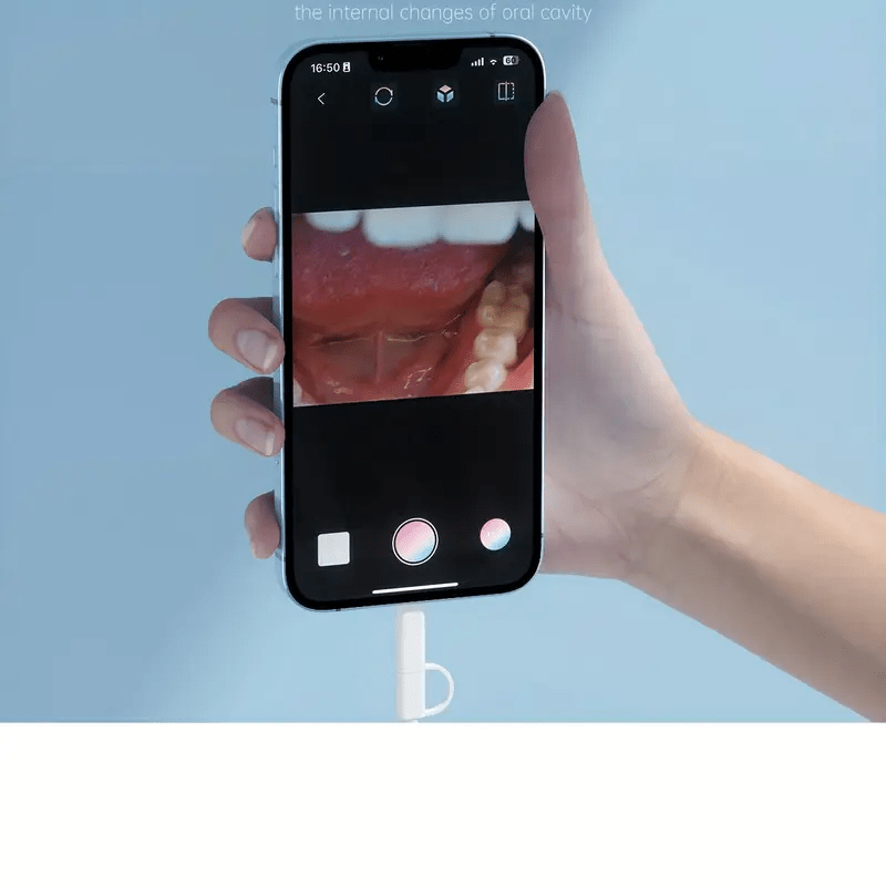 HD Intraoral Camera (Android & iOS Compatible) – 1920×1440, 8 - LED - Ivy AI